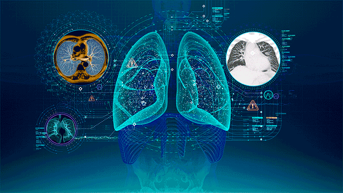 Our EchoMD AutoEF software receives FDA clearance for fully automated AI echocardiogram analysis